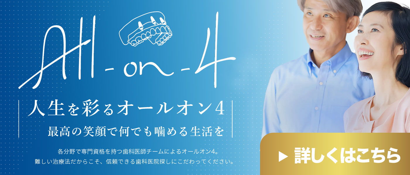 オールオン4