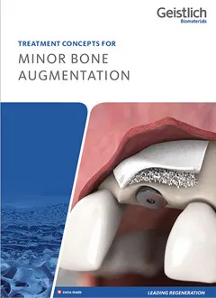 「MINOR BONE　AUGMENTATION」
